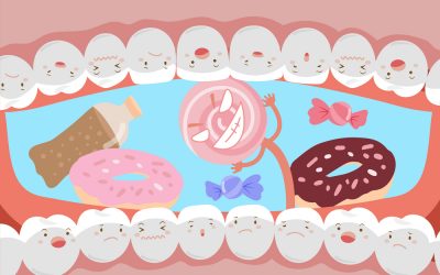 Sugar and Gum Disease – This is New!